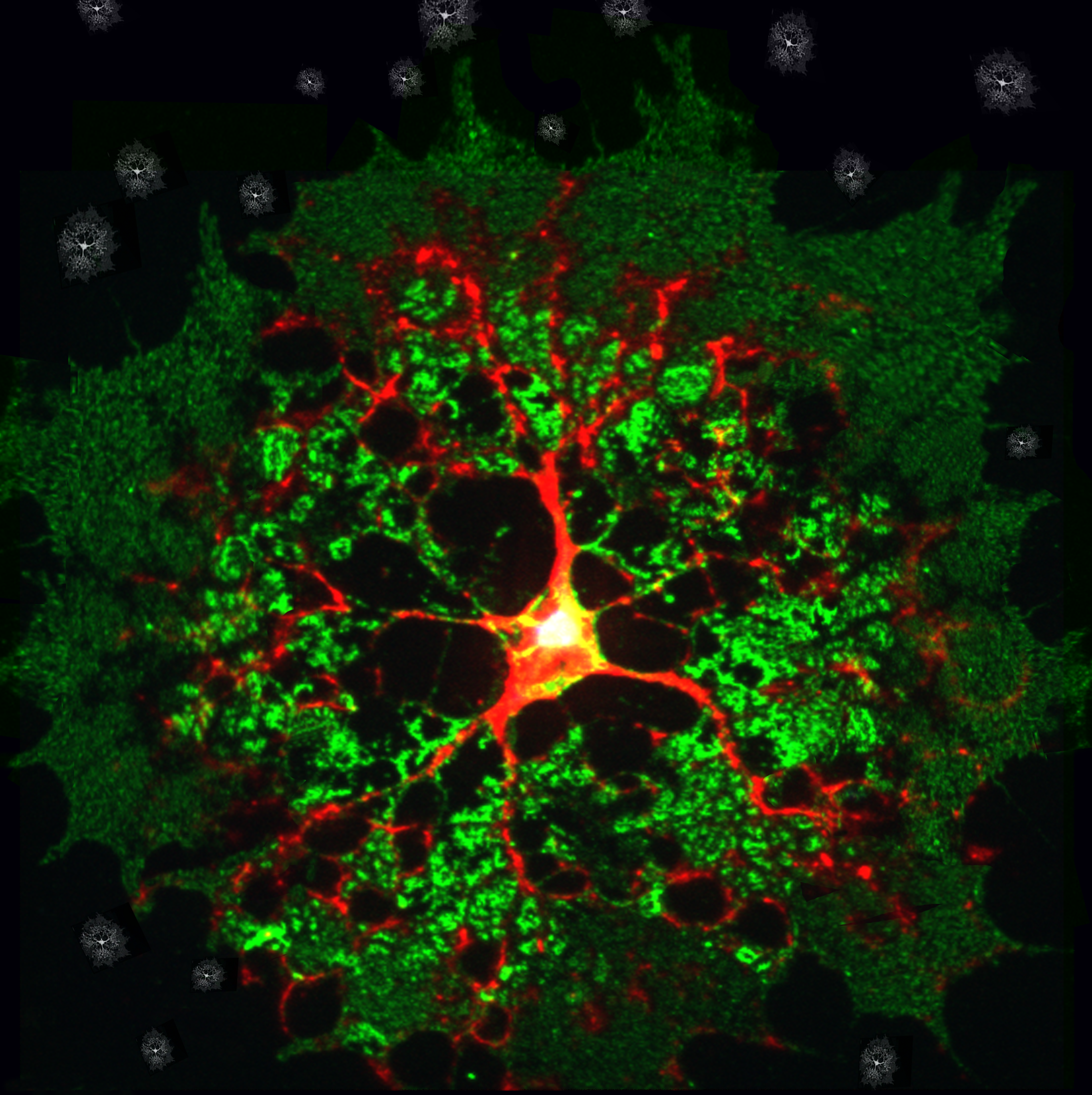 Les protecteurs de notre système neuronal aussi complexes que leur nom : les oligodendrocytes  